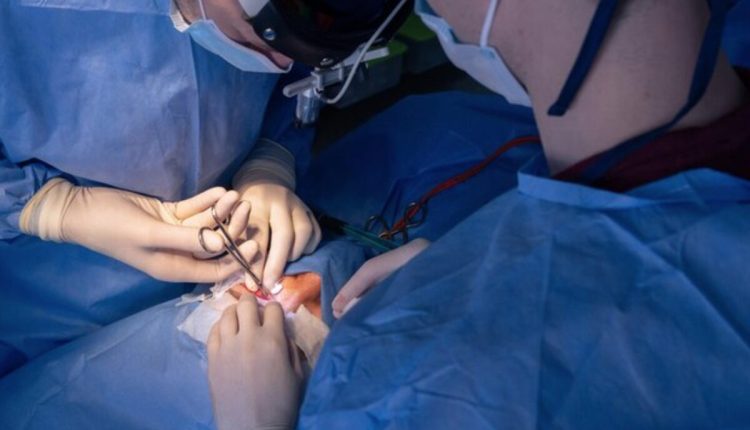 بلفاروپلاستی